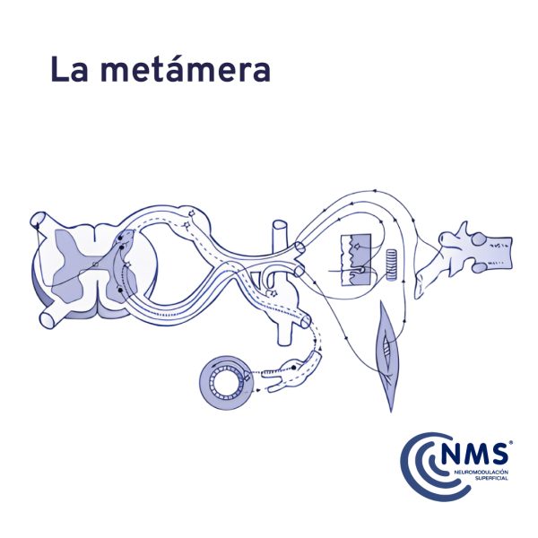 La Metámera