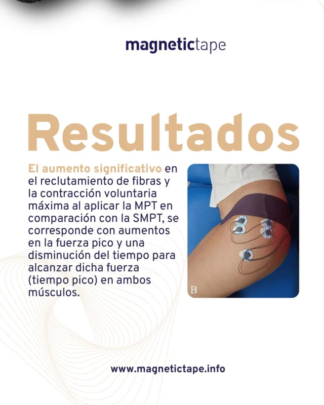 Resultados del estudio:  La aplicación de MPT, en comparación con SMPT, mostró un aumento significativo en el reclutamiento de fibras y en la contracción voluntaria máxima.
Esto se traduce en una mayor fuerza pico y reducción del tiempo necesario para alcanzarla (tiempo pico) en ambos músculos evaluados.  Más información en:
www.magnetictape.info